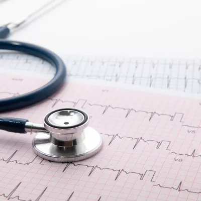 Blue Stethoscope on electrocardiogram (ECG) chart paper.