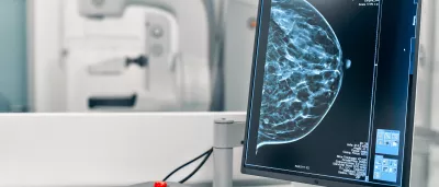 Image of a mammogram