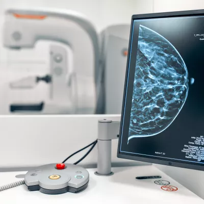 Image of a mammogram