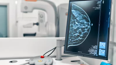 Image of a mammogram
