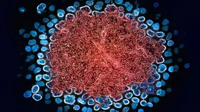 Microscopic view of HIV-1 virus particles