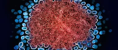 Microscopic view of HIV-1 virus particles