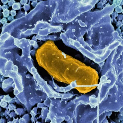 Electron micrograph of Salmonella Typhimurium invading a human epithelial cell