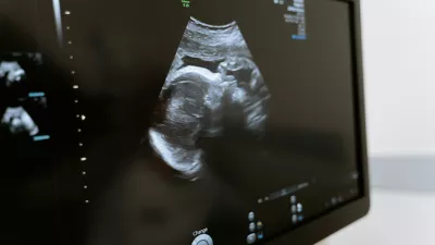 an ultrasound of an unborn fetus